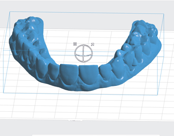 Laboratorio cad/cam - Ozeta Dental Center